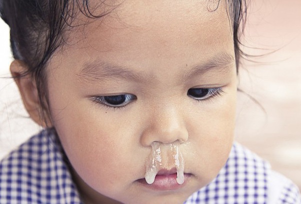 nước mũi có mùi hôi ở trẻ em