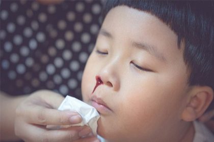 trẻ bị chảy máu mũi khi ngủ